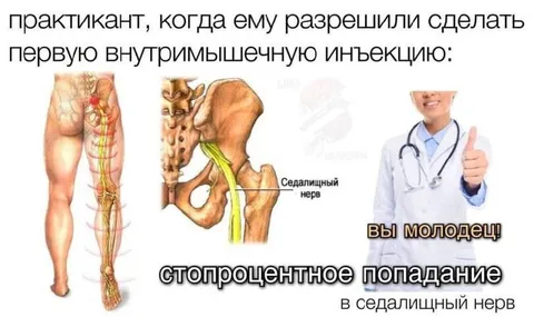 Стопроцентное попадание в седалищный нерв