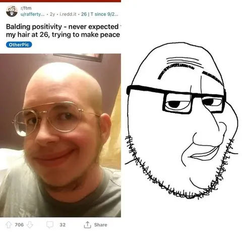 Balding Positivity at 26