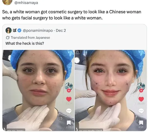 Cosmetic Surgery Identity Swap