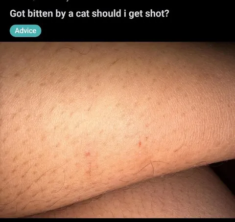 Cat Bite Advice Question