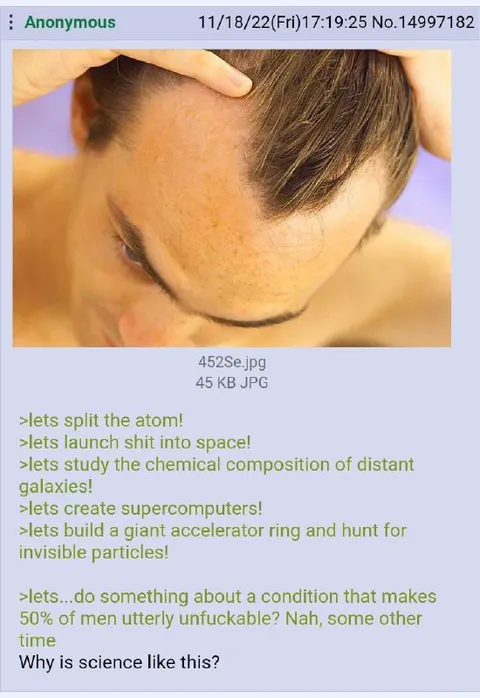 Science Solves Everything Except Baldness