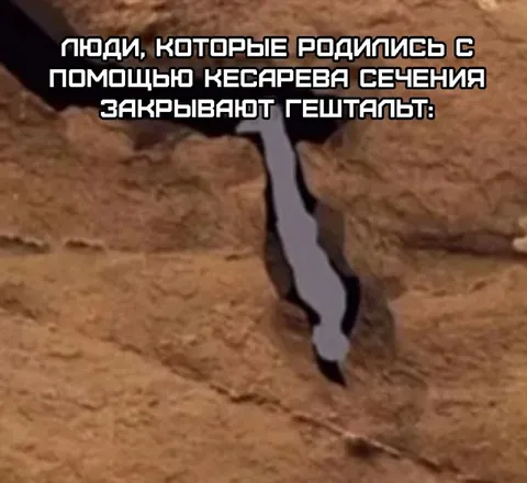 Закрывают гештальт кесаревым сечением