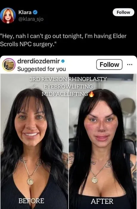 Elder Scrolls NPC Surgery