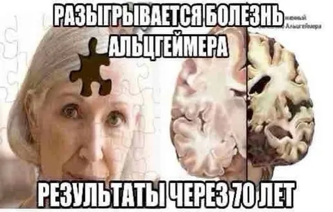 Разыгрывается болезнь Альцгеймера