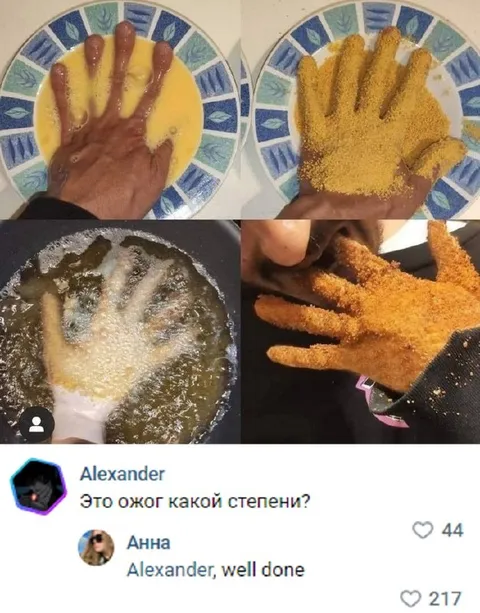 Жареная рука и ожог