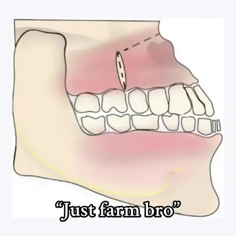 Just Farm Bro Explains Everything