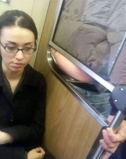 Рентген показывает всё