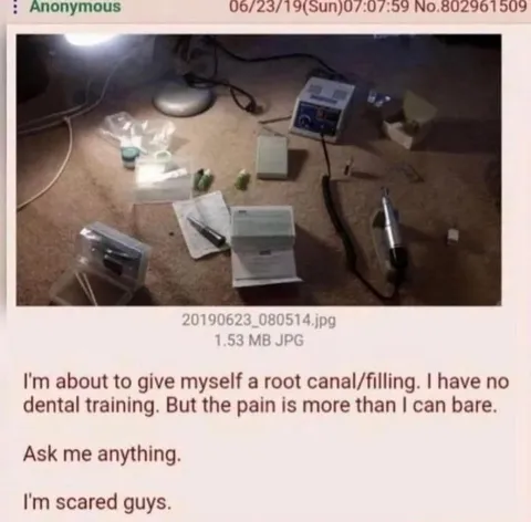 DIY Root Canal Panic