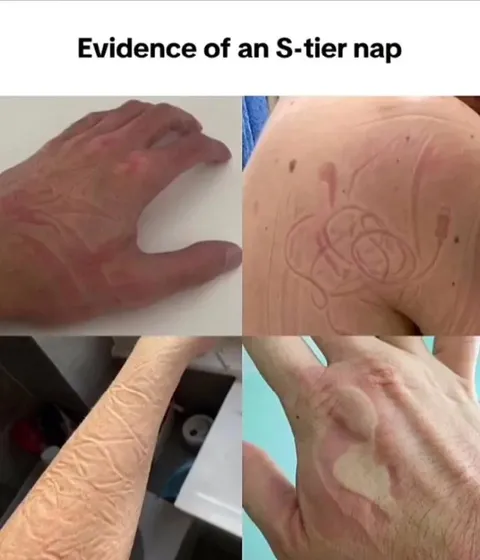 Evidence of an S-tier nap
