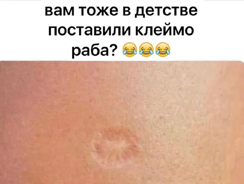 Клеймо раба из детства
