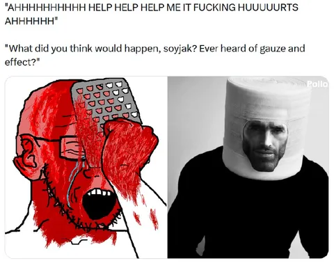 Soyjak Discovers Gauze Effect