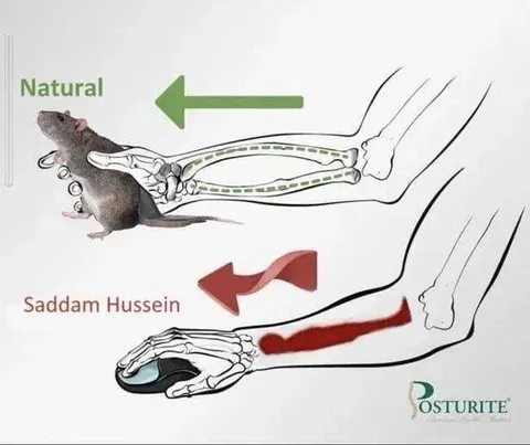 Natural vs Saddam Hussein Foot