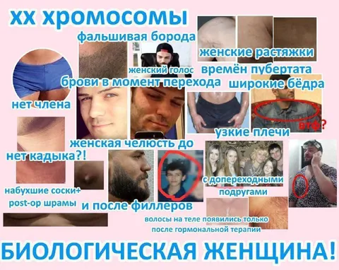 Биологическая женщина с XX хромосомами