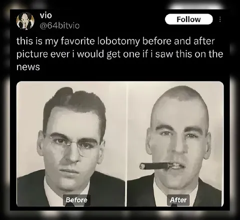 Favorite Lobotomy Before and After