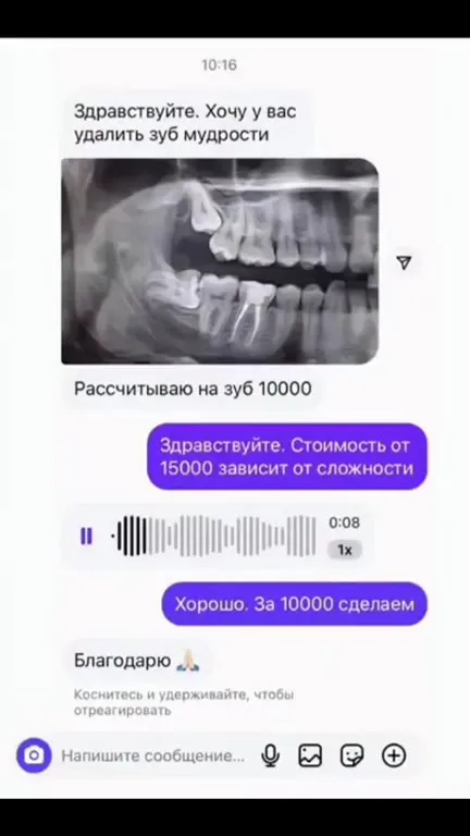 Удаление зуба мудрости за 10000