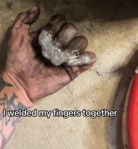 I Welded My Fingers Together
