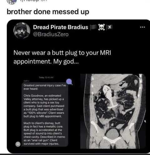 Brother Done Messed Up MRI