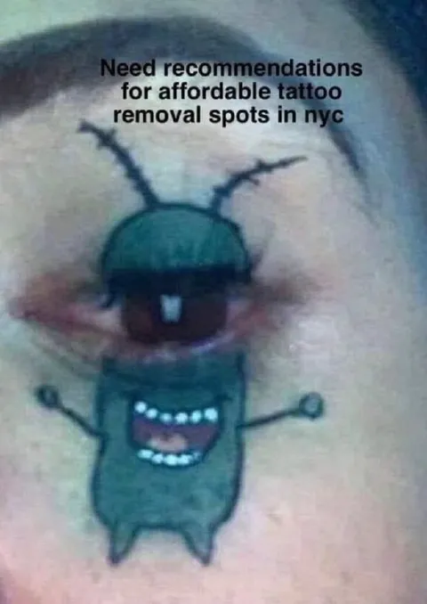Affordable Tattoo Removal Spots