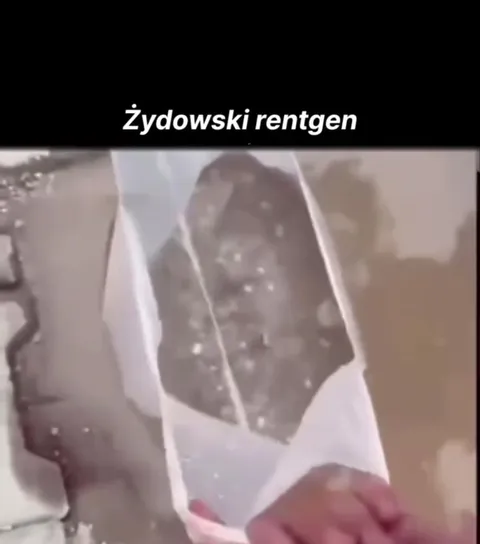 Żydowski rentgen i ukryta moneta