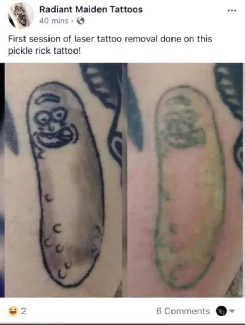 Pickle Rick Tattoo Removal