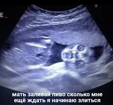 Малыш требует пиво на УЗИ