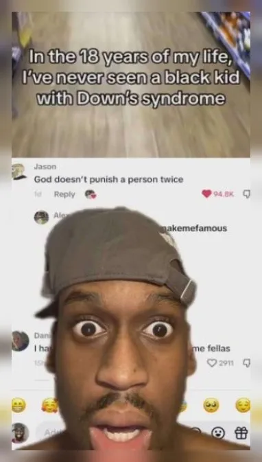 Black Kid With Down's Syndrome