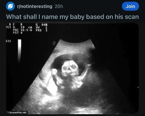Baby Name Based on Ultrasound