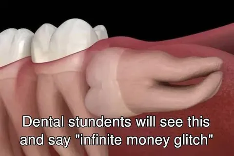 Infinite Money Glitch for Dental Students