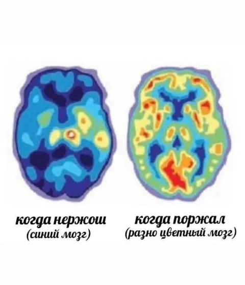 Мозг когда нервничаю и поржал