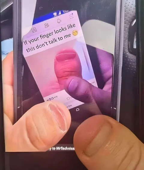 Finger Looks Like This
