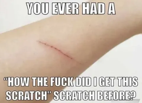 How Did I Get This Scratch