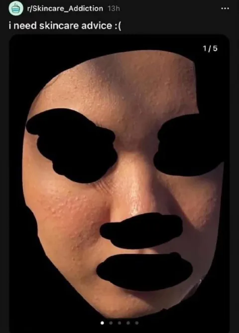 I Need Skincare Advice