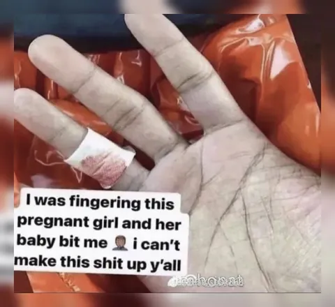Pregnant Girl’s Baby Bit Me