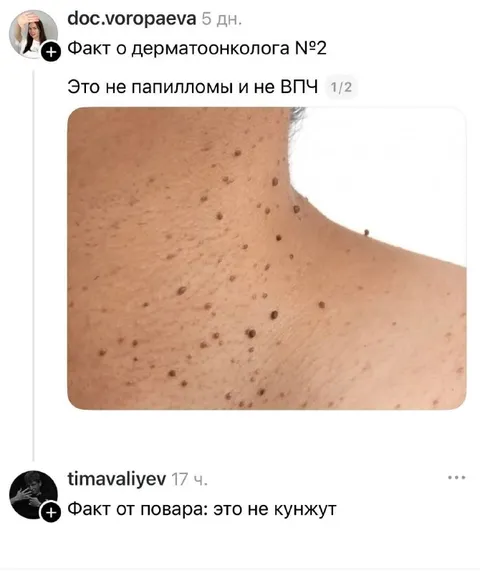 Это не кунжут