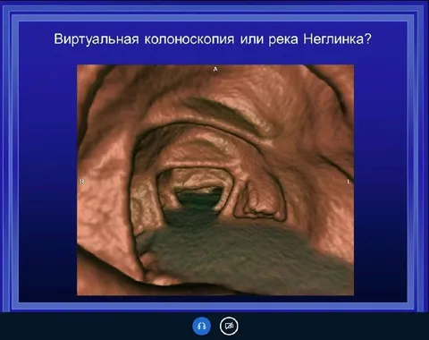 Виртуальная колоноскопия или река Неглинка