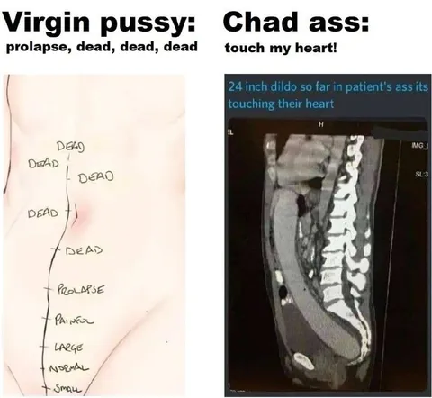 Virgin Pussy vs Chad Ass
