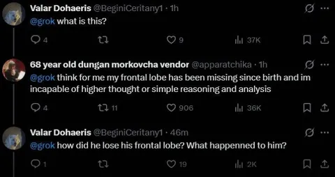 Missing Frontal Lobe Joke