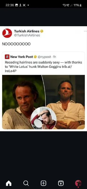 Receding Hairlines Are Sexy Now