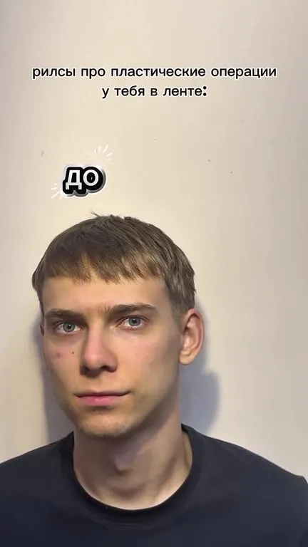 Пластическая операция из рилсов