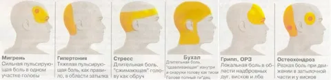 Виды головной боли