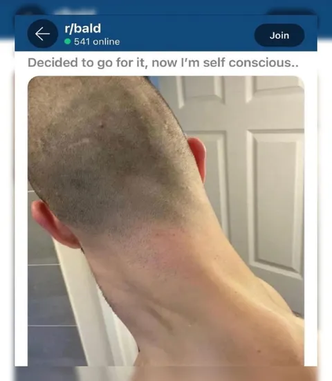 Decided to Go Bald