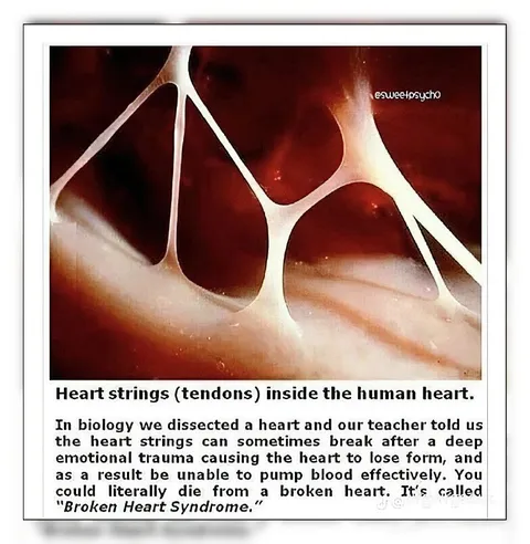 Broken Heart Syndrome Diagram