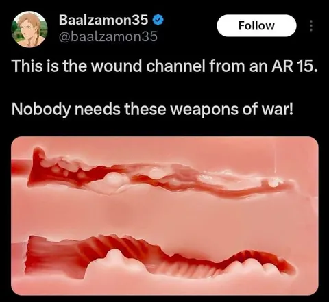AR-15 Wound Channel