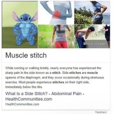 Muscle Stitch Side Pain
