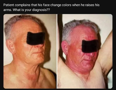 Face Changes Color Diagnosis