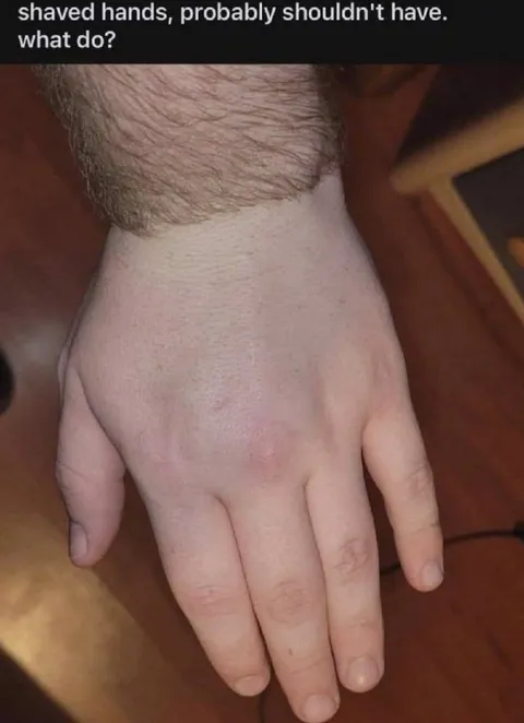 Shaved Hands Regret