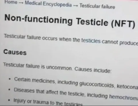 Non-Functioning Testicle NFT