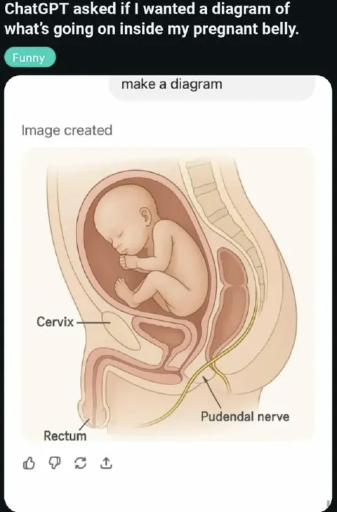 Pregnant Belly Diagram Gone Wrong