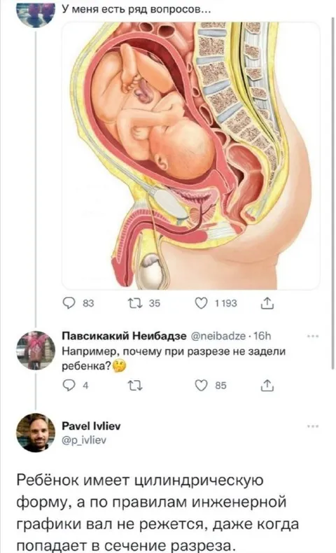 Почему ребёнка не разрезали