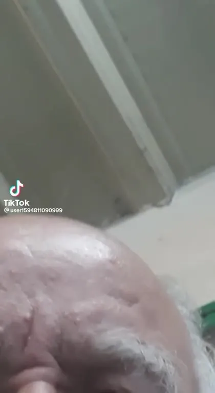 Драматичный взгляд на лысину